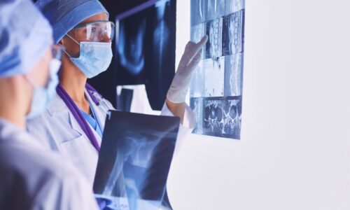 Resumo do Webinar sobre a ferramenta OncoQuant com Lucas Friguetto da GE HealthCare