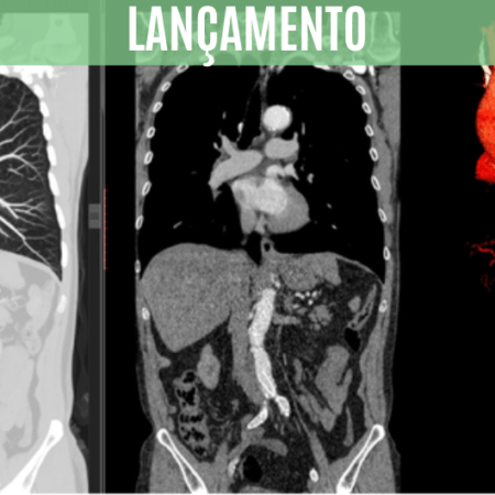 Pós-graduação em Tomografia Computadorizada