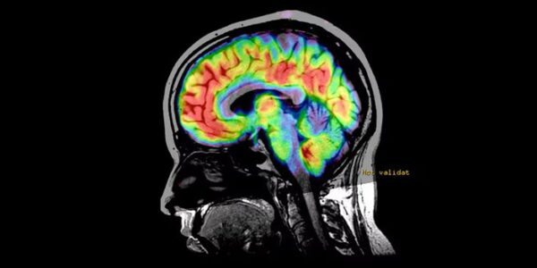 Técnicas e Pós-processamento em Neuroimagem por RM