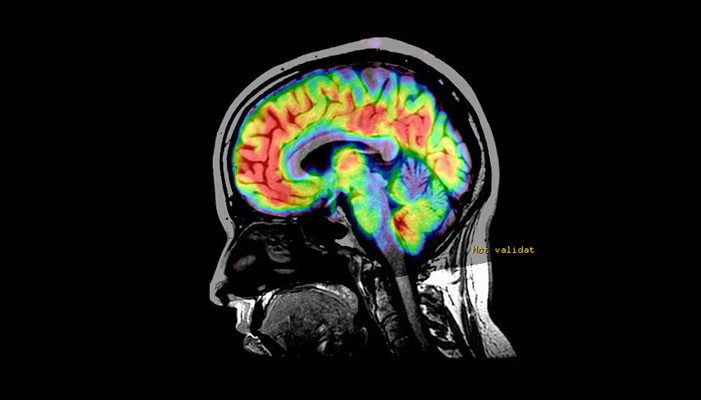 Técnicas e Pós-processamento em Neuroimagem por RM