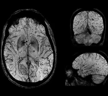 Neuroanatomia: Bases e aplicação em exames de Imagem