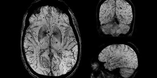 Neuroanatomia: Bases e aplicação em exames de Imagem