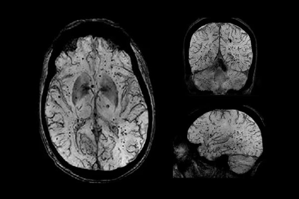 Neuroanatomia: Bases e aplicação em exames de Imagem
